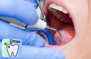 口腔内クリーニング