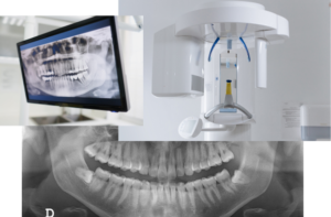 歯科用レントゲン装置
